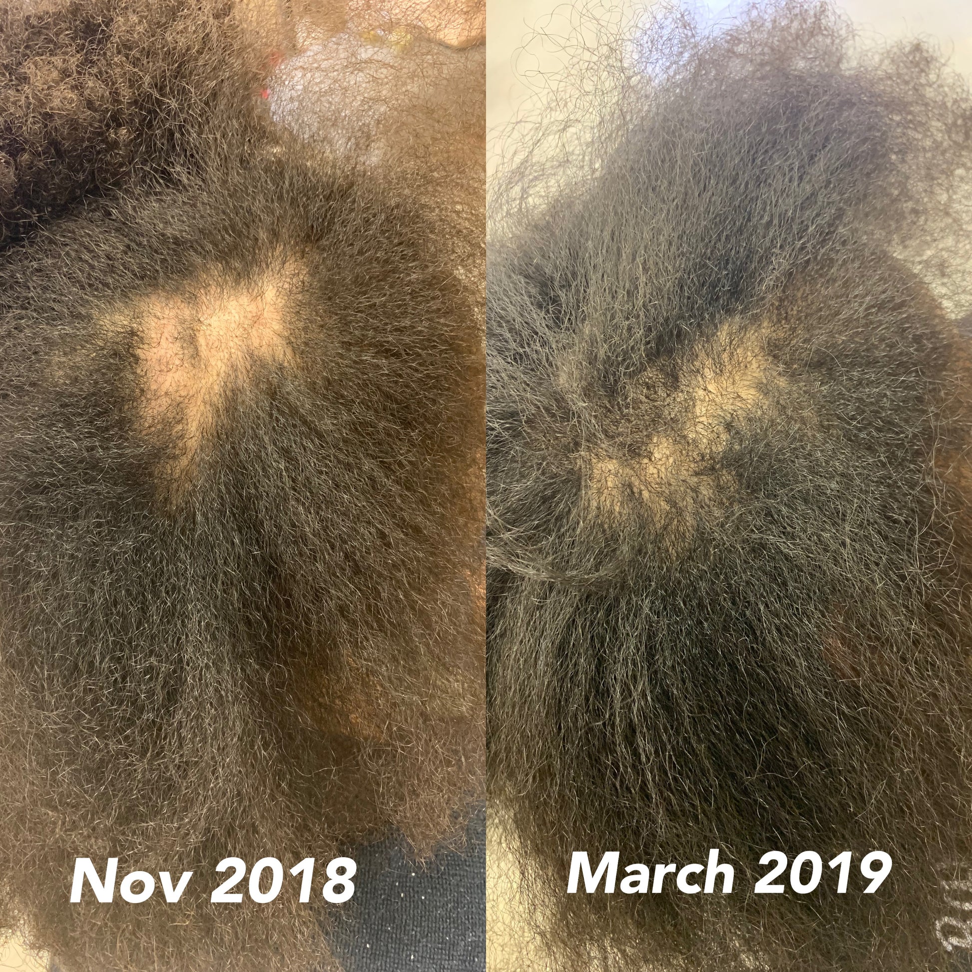 Let it Grow  Hair Growth Oil - Beyoutiful Hair by Nicky